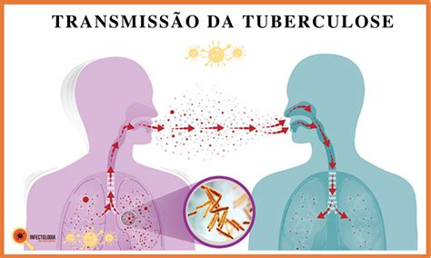 transmissão da tuberculose